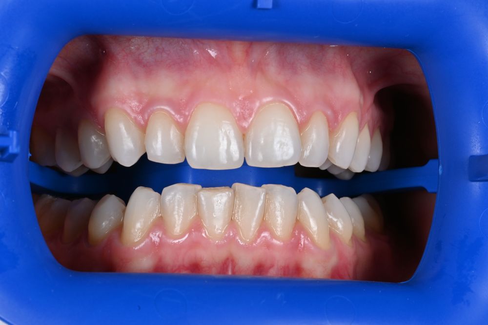 Изображение до