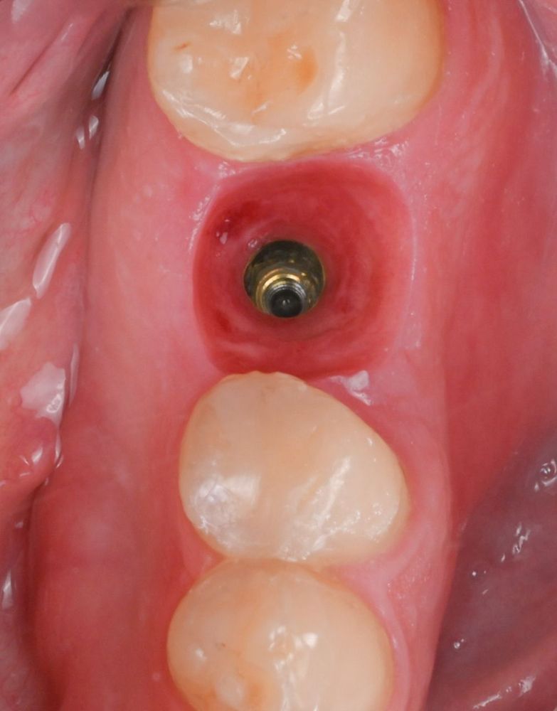 Изображение до