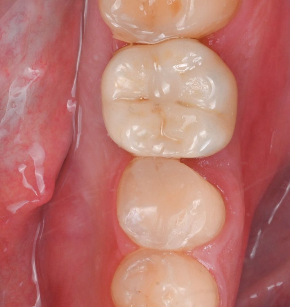 Изображение после