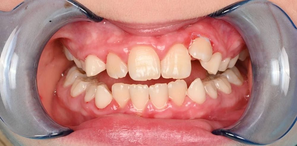 Изображение до