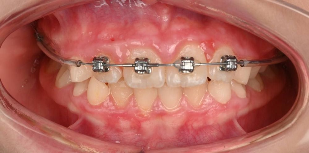 Изображение после