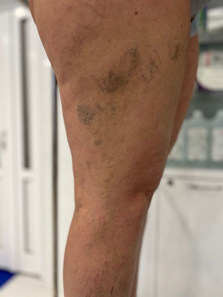 Изображение до