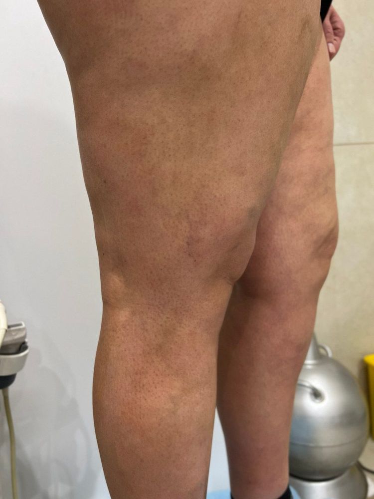 Изображение после