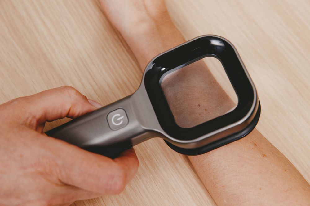 Симптомы, при которых нужна консультация дерматолога: