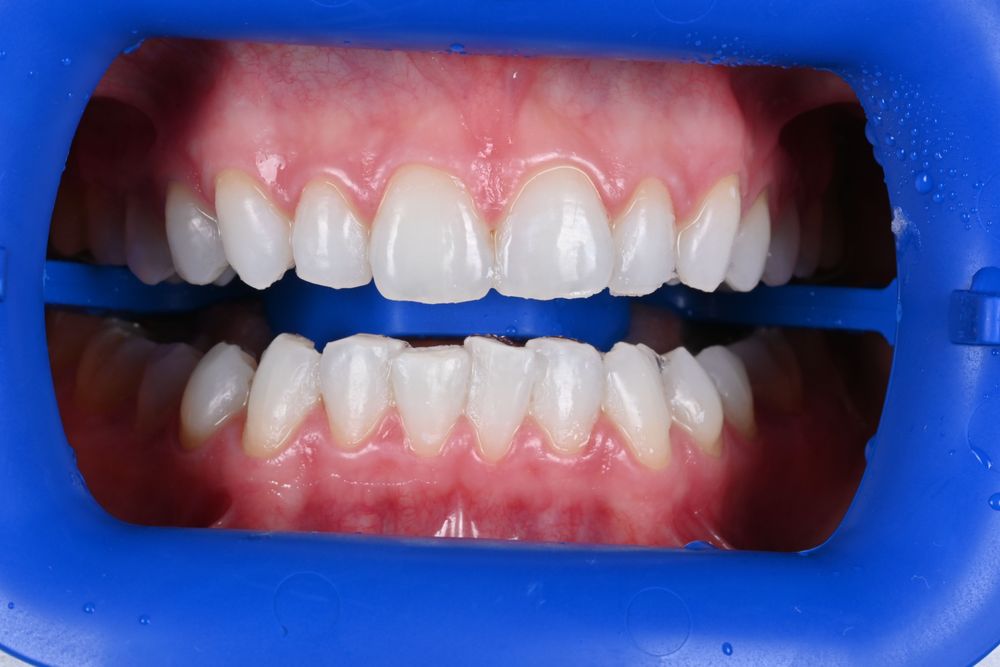 Изображение после