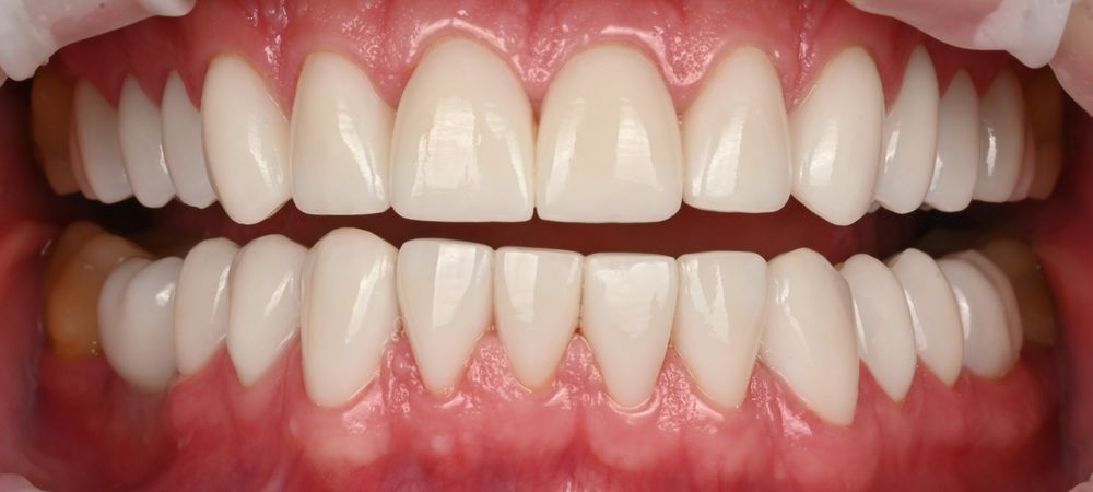 Изображение после