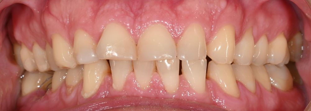 Изображение до