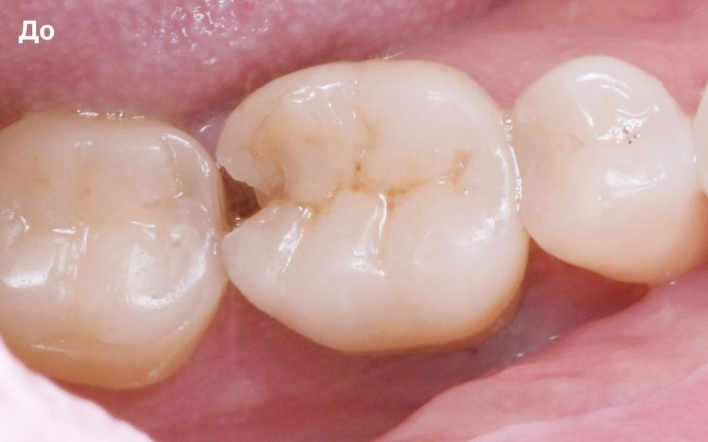 Изображение до