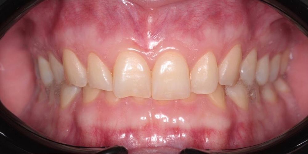 Изображение до