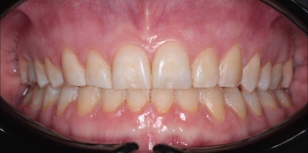 Изображение после