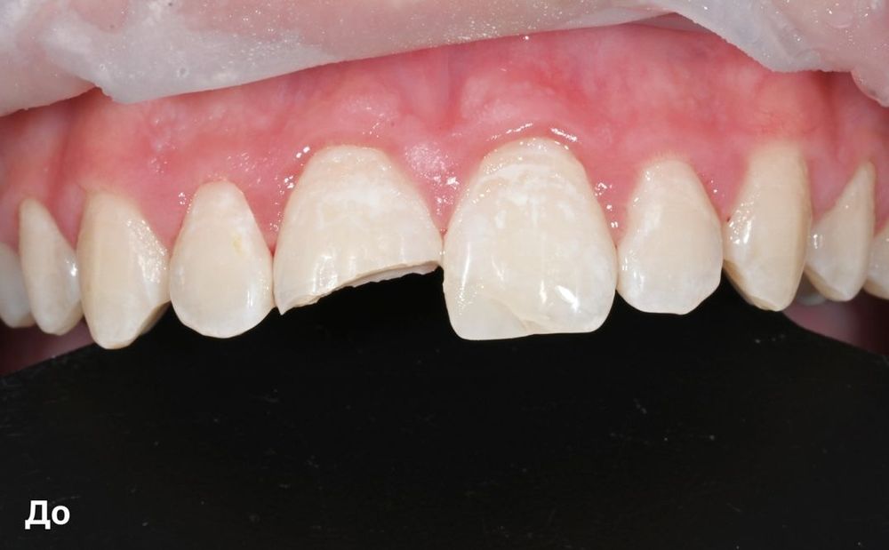 Изображение до