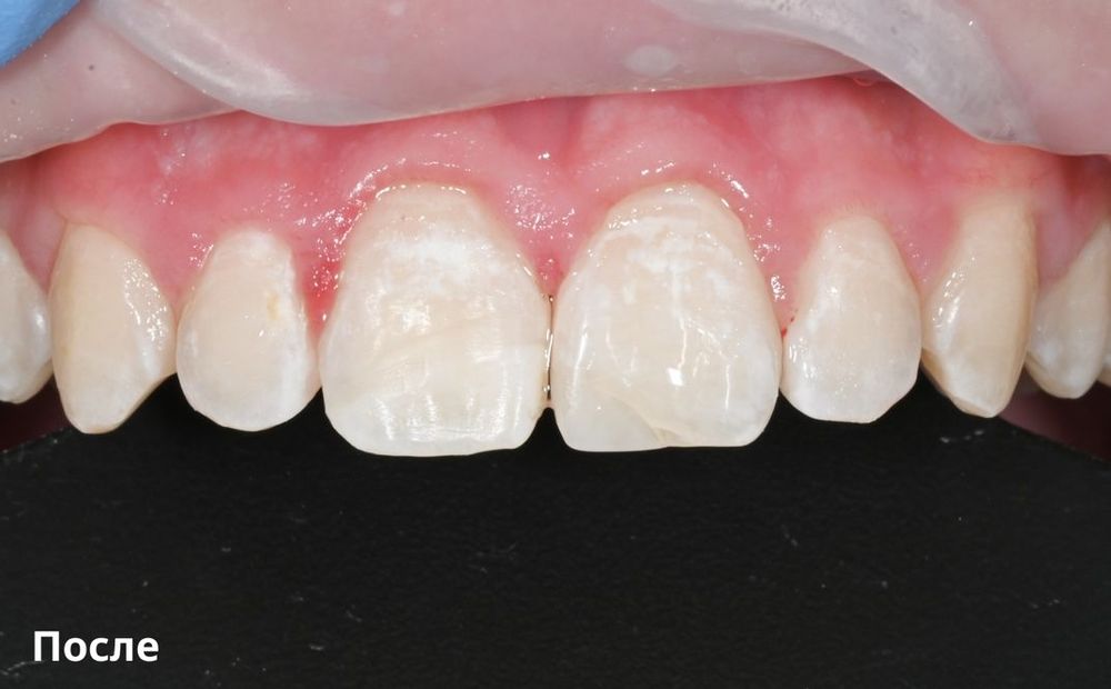 Изображение после