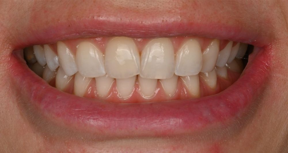 Изображение до