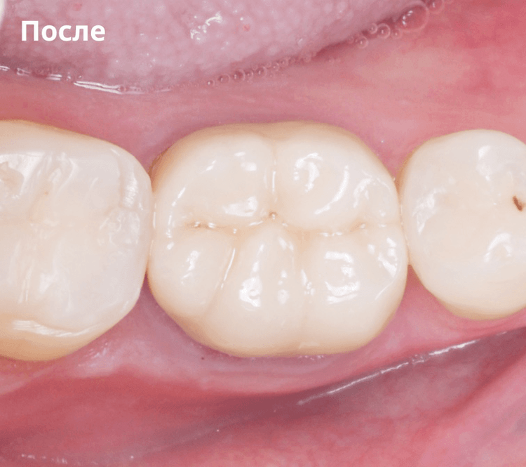 Изображение после